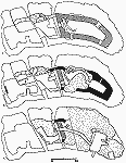 pdorys palc - A) sutern, B) pzem, C) 1. patro